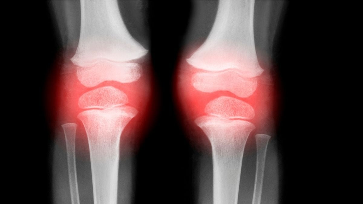 Breakthrough To Restore Aging Joints Could Help Treat Osteoarthritis : ScienceAlert