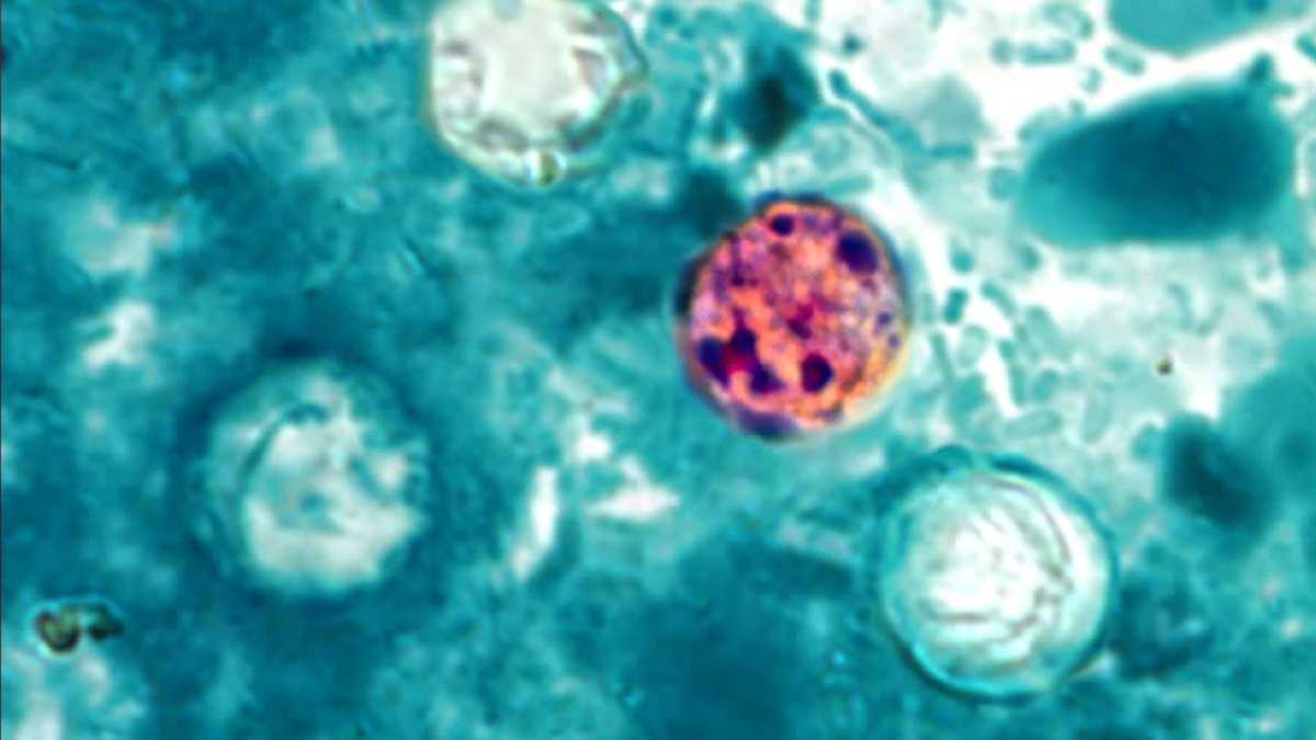Cyclospora outbreak linked to iceberg lettuce in Douglas County