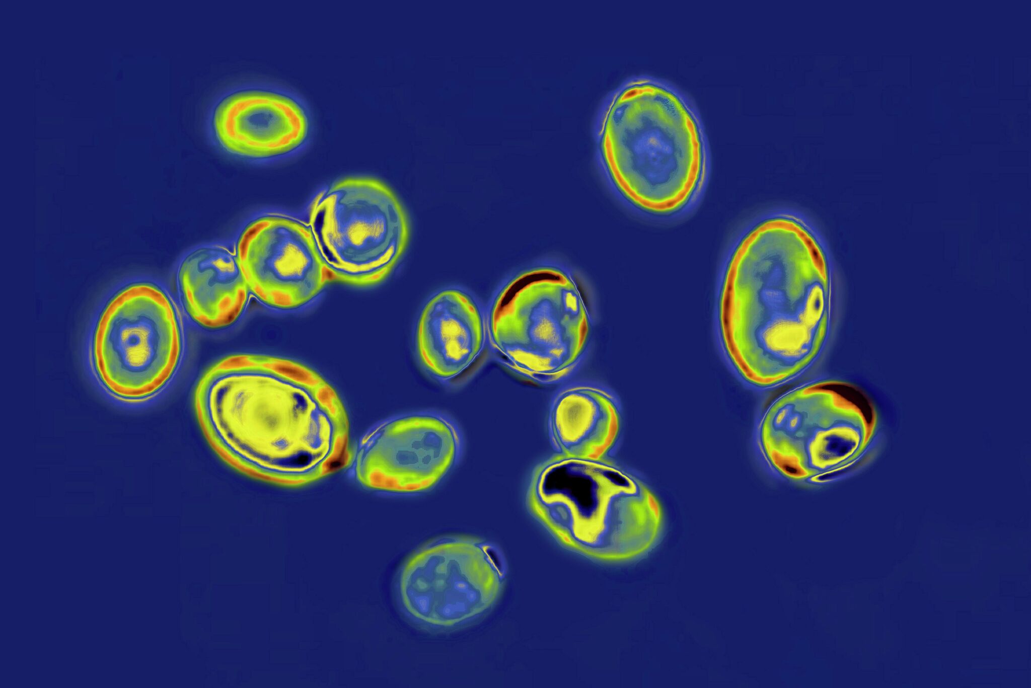 Drug-resistant fungus Candida auris spreads in Texas and US