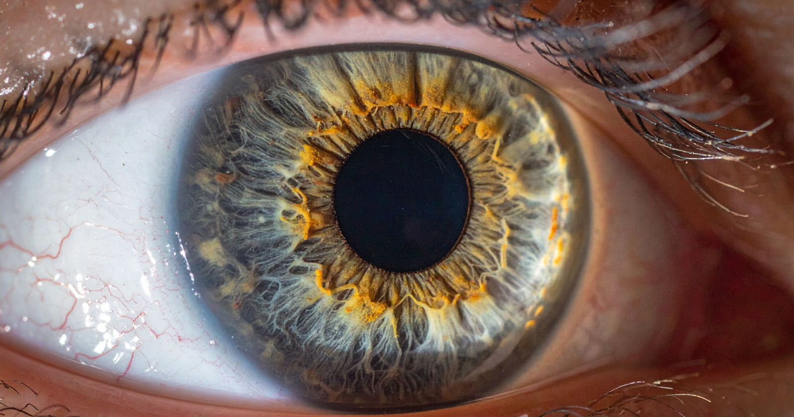 In 2017, a young woman glanced at a solar eclipse for only a handful of seconds, and days later doctors found the exact shape of the eclipse burned into the back of her eye. What she began drawing to describe her ruined vision matched that shape almost perfectly.