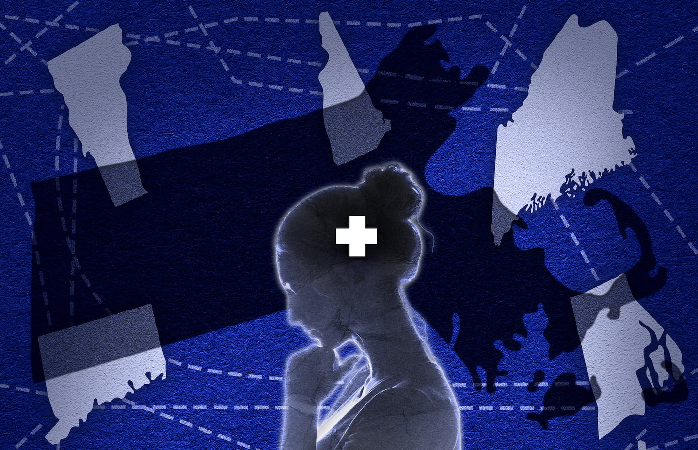 Massachusetts trails most states on inter-state therapy access