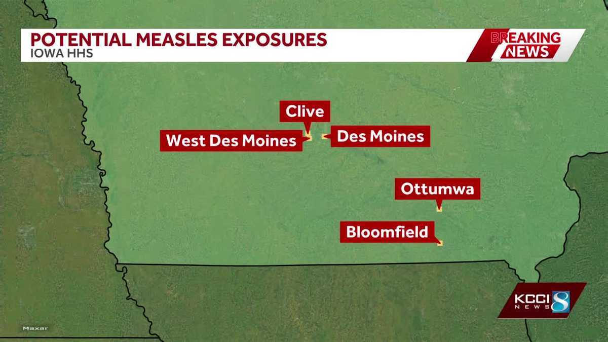Measles in Iowa: Pizza Ranch in Ottumwa named potential exposure location