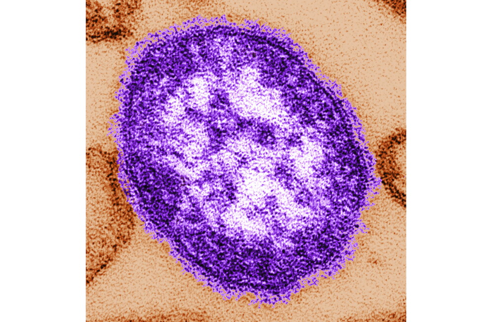 Pennsylvania reports first 2 US measles deaths in 2026