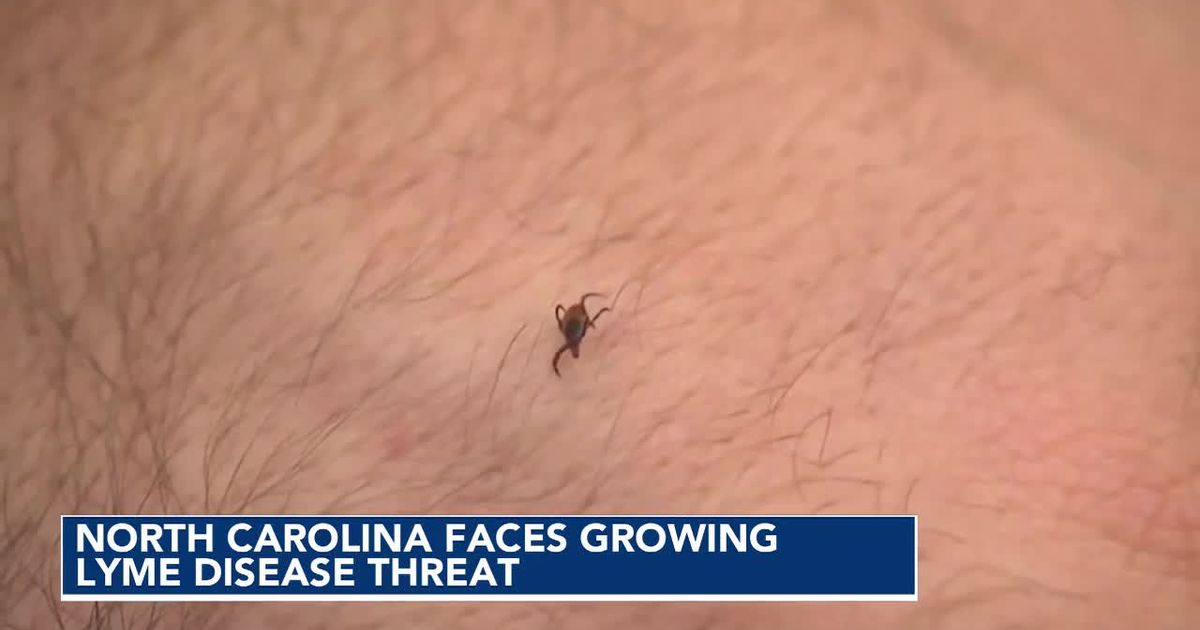 Ticks carrying Lyme disease are gaining ground in North Carolina, study finds :: WRAL.com