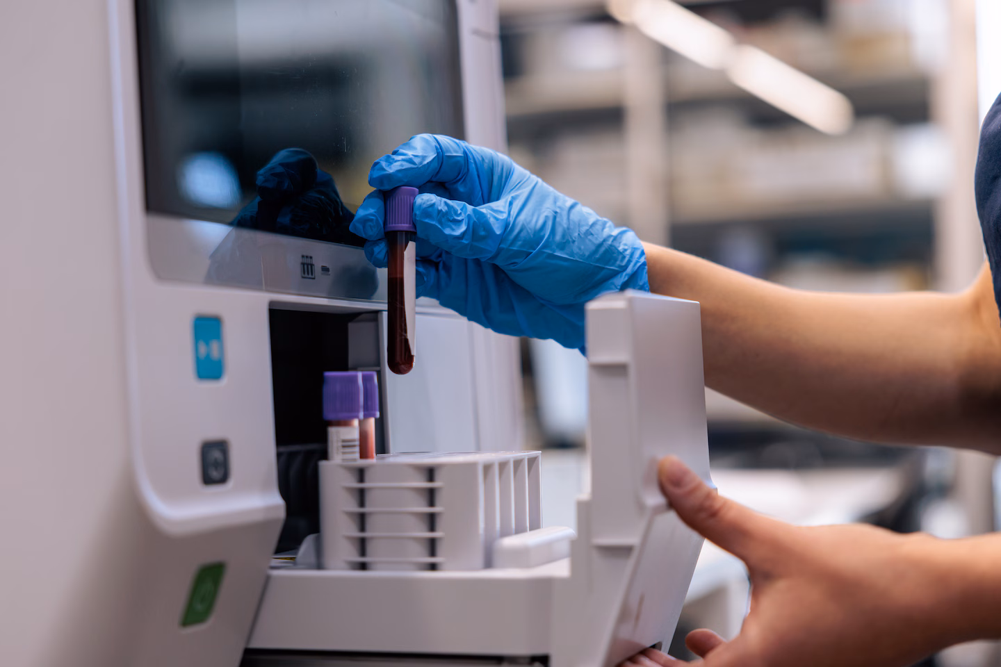 What a lipoprotein(a) test can tell you about your heart health