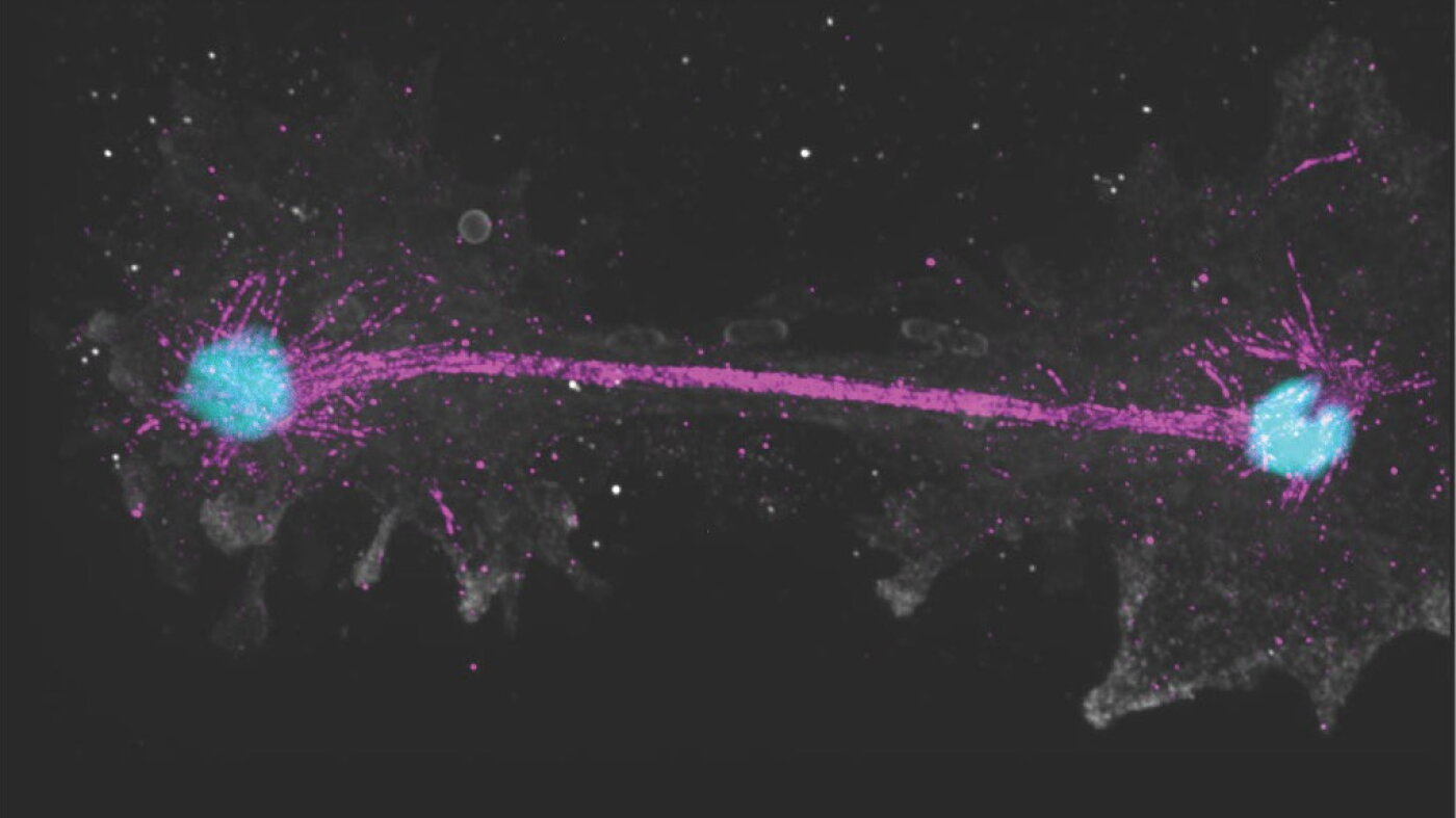 'Fire amoeba' can withstand record-breaking temperatures : NPR