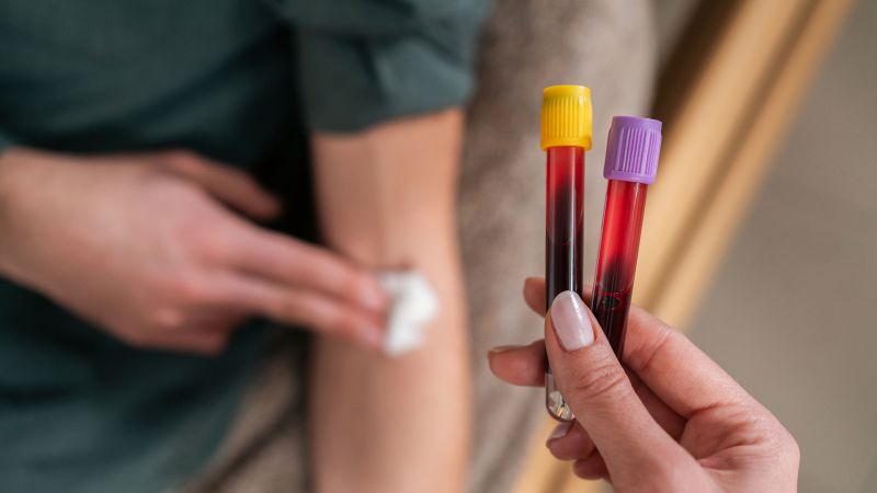 First on CNN: Routine blood testing may hold hidden clues to colorectal cancer before age 45