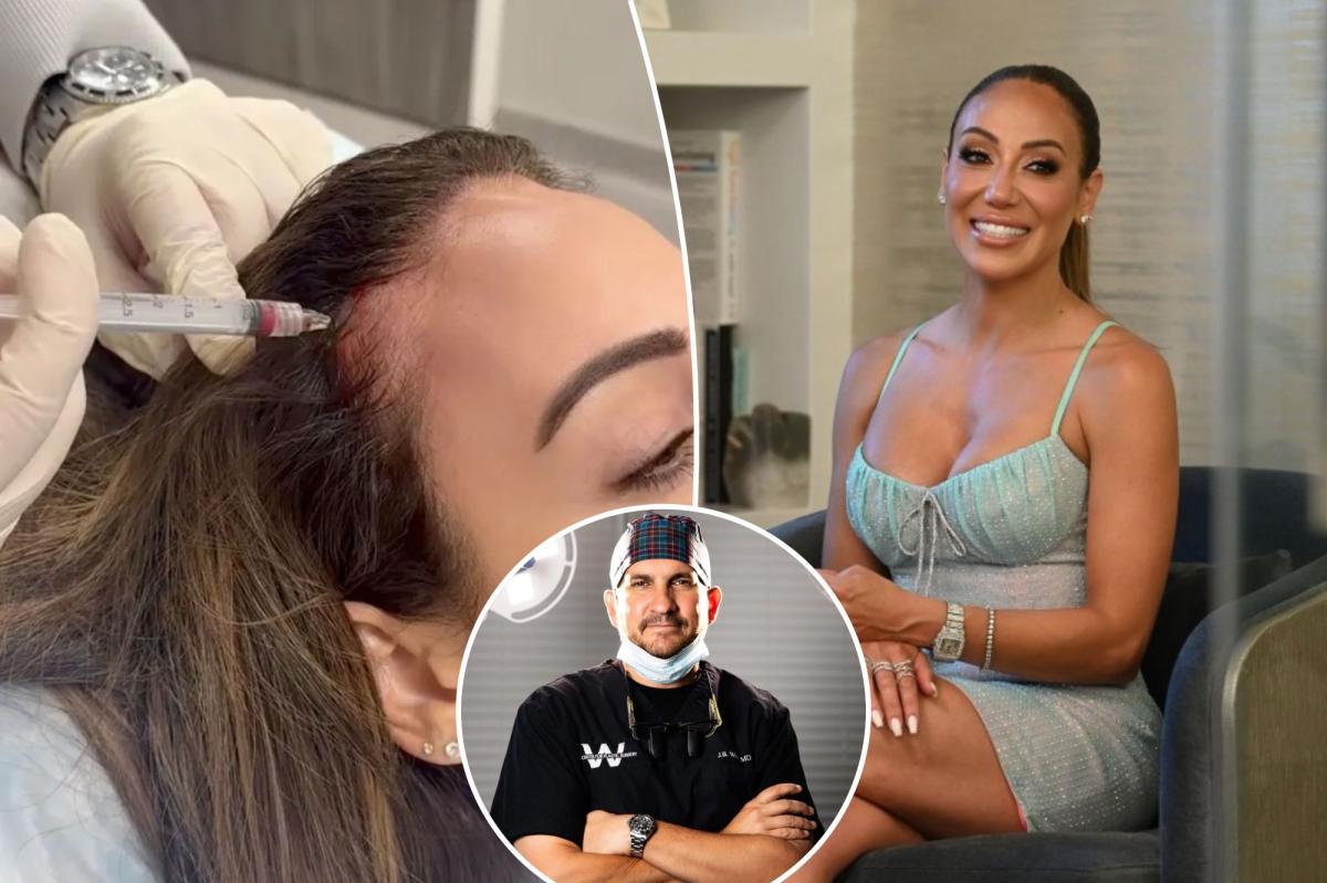 How I restored Melissa Gorga’s thinning hair
