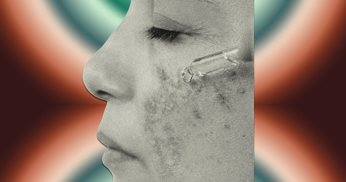 Now Is a Good Time to Start Your Melasma Routine: Products