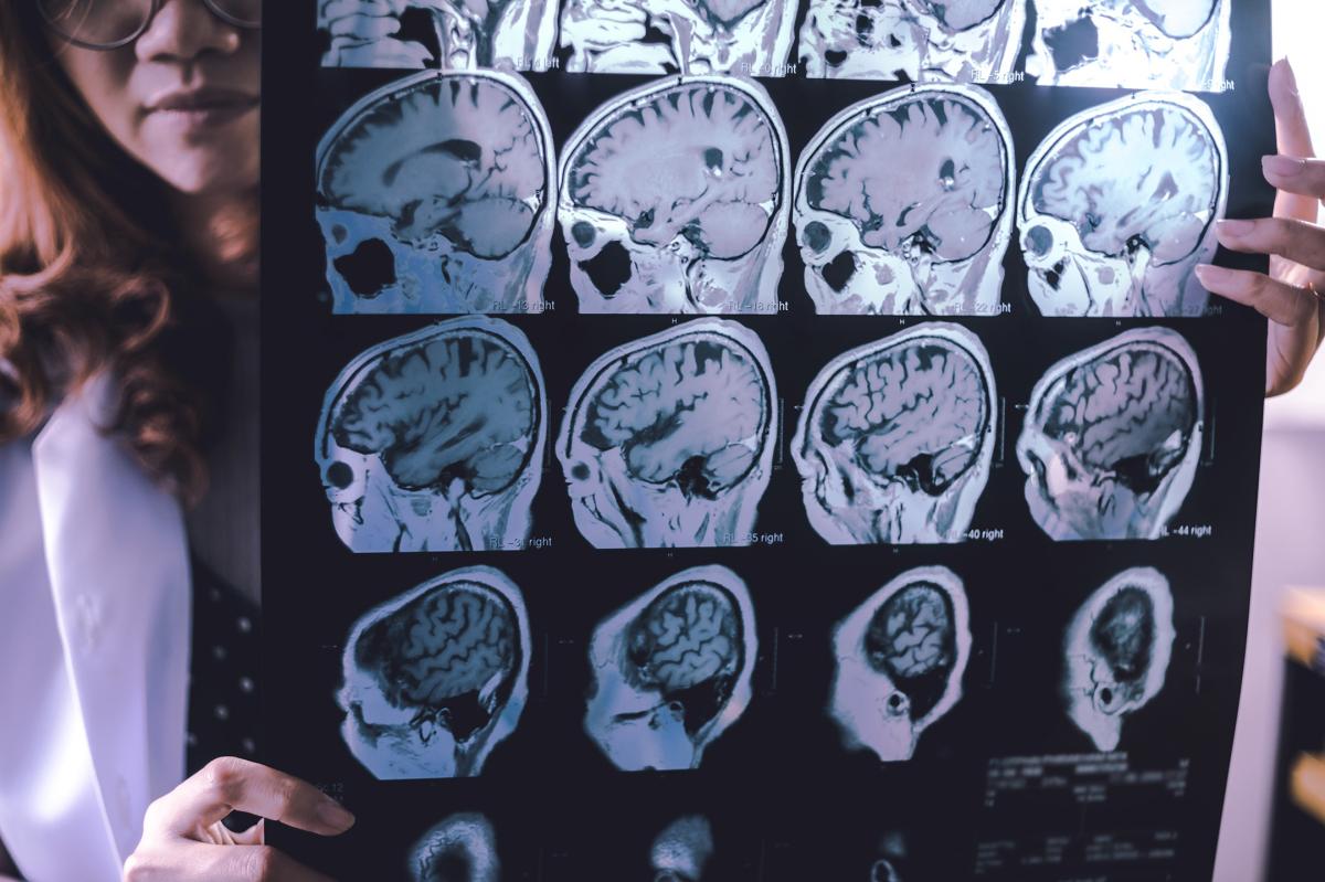 One family's struggle with early dementia may lead us to a cure