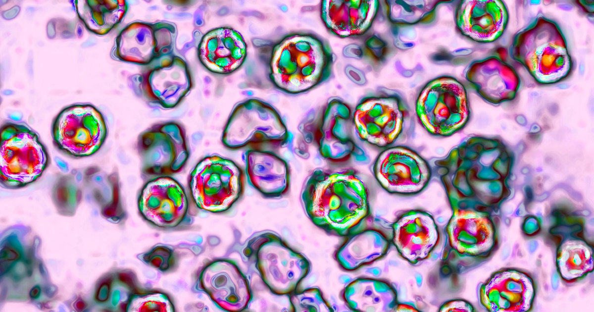 Pennsylvania teen dies from measles complications, the state’s fourth death