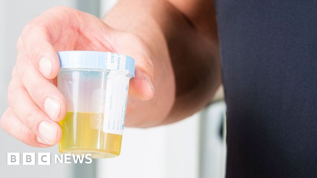 Urine test can spot more than nine in 10 bladder cancers - BBC
