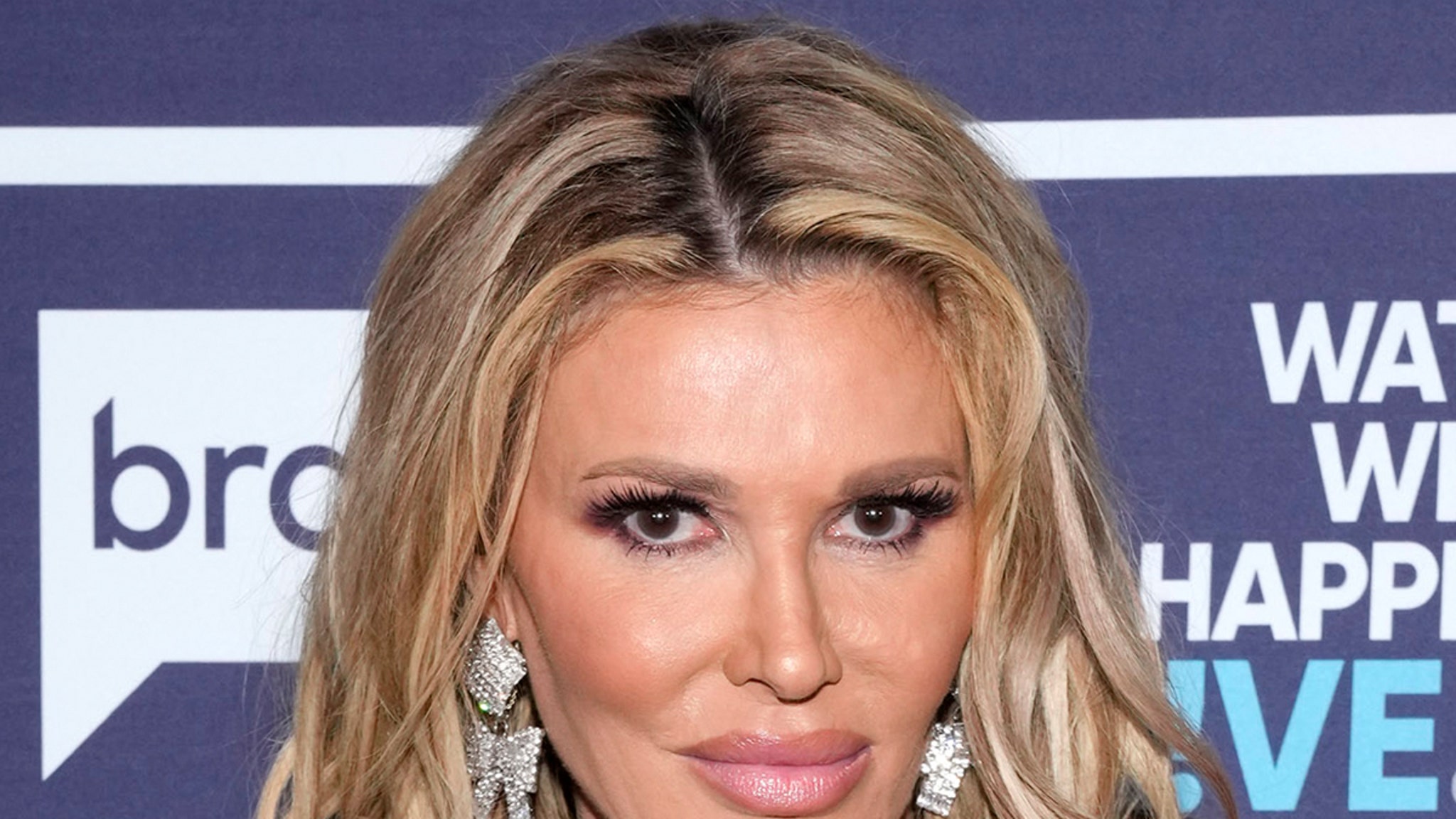 Brandi Glanville Undergoing Surgery To Remove Facial Gunk and Organisms