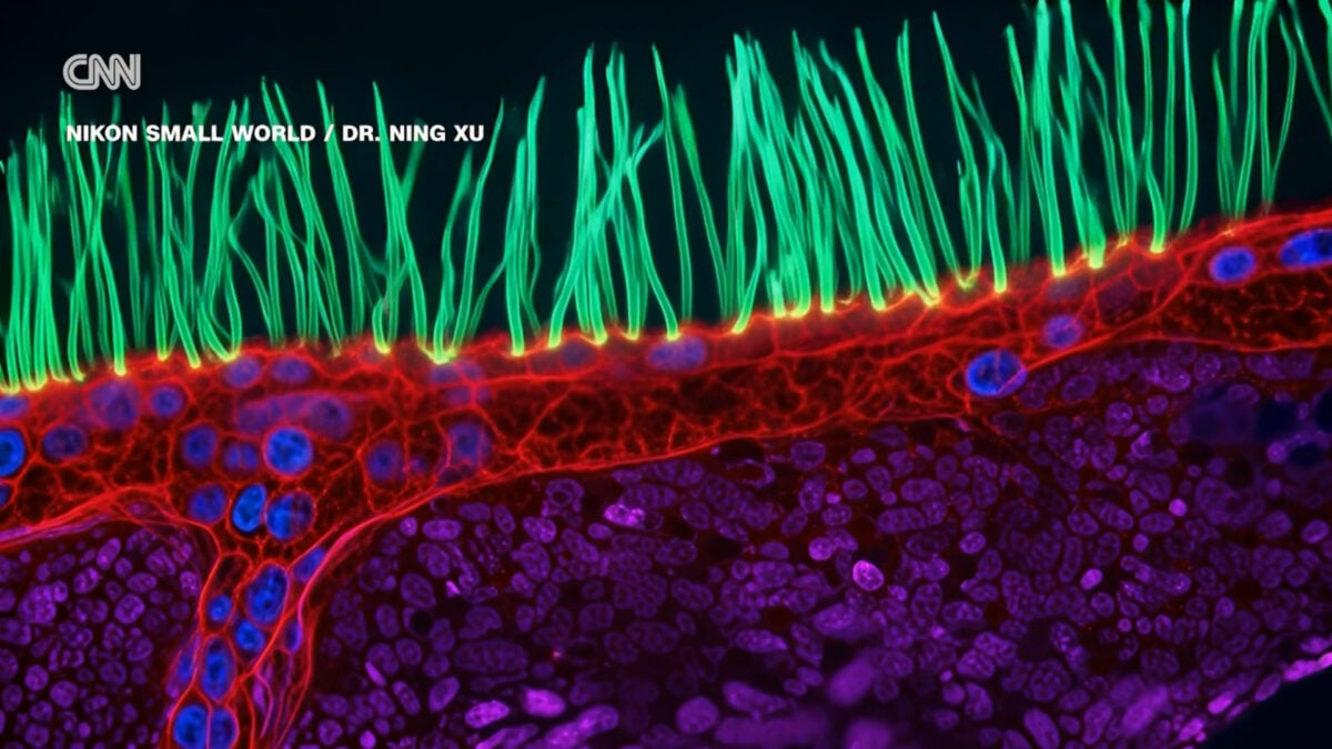 Contest-Winning Microscope Video Is Full of AI Confabulations, Scientists Say