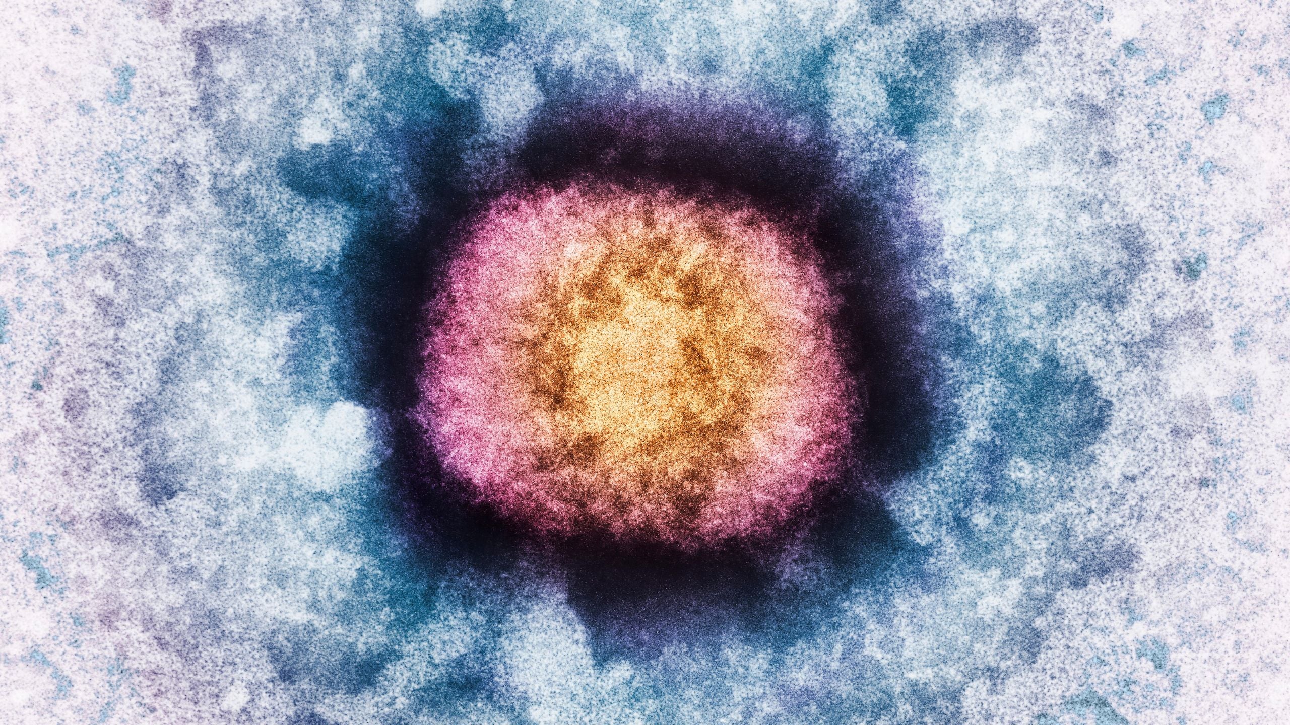 DNA From a Human Brain Gene Has Turned Up In a Virus : ScienceAlert