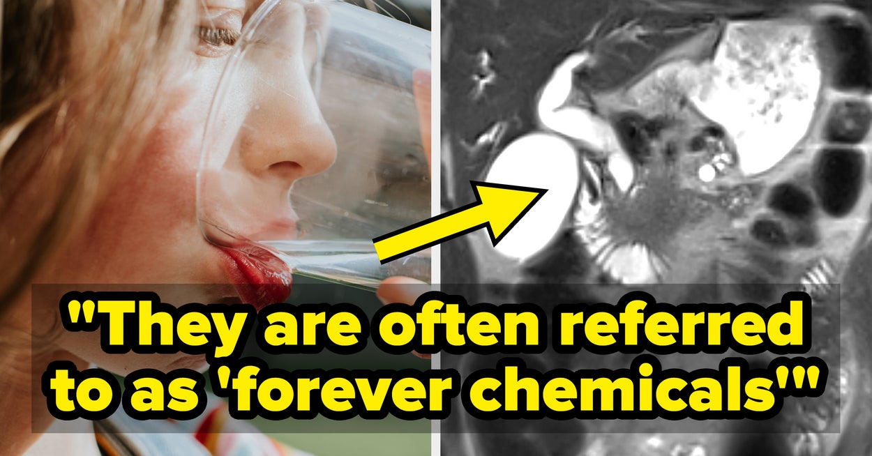 Doctors Are Begging You To Pay Attention To This Popular Drink That Could Increase Your Risk Of Colorectal Cancer - BuzzFeed