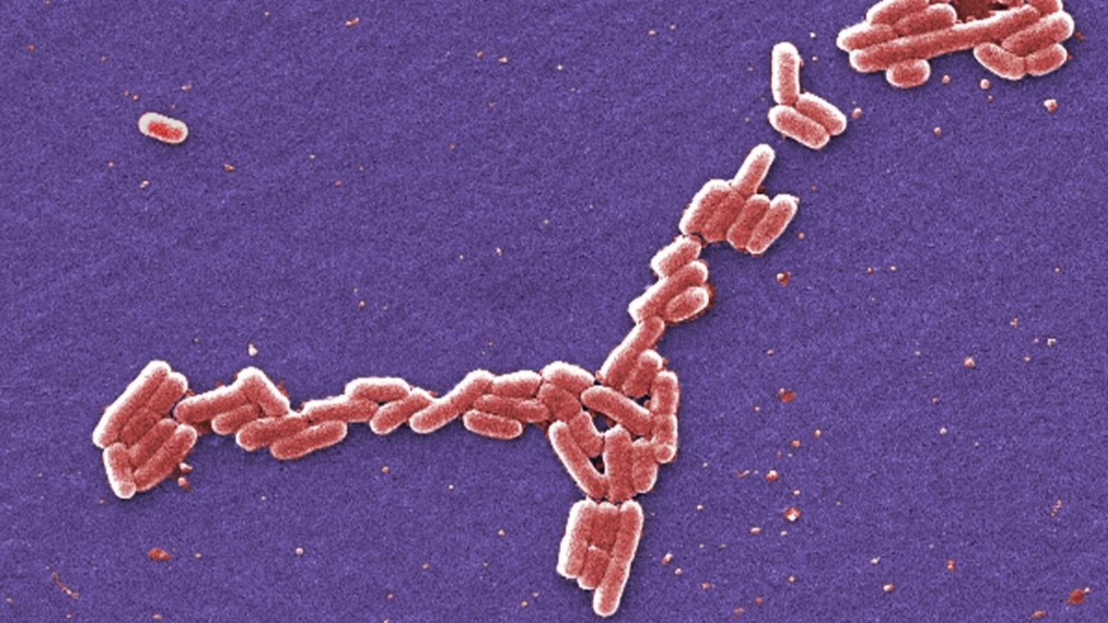 E. coli cases possibly linked to Bengtson's Pumpkin Farm, Will County health officials say