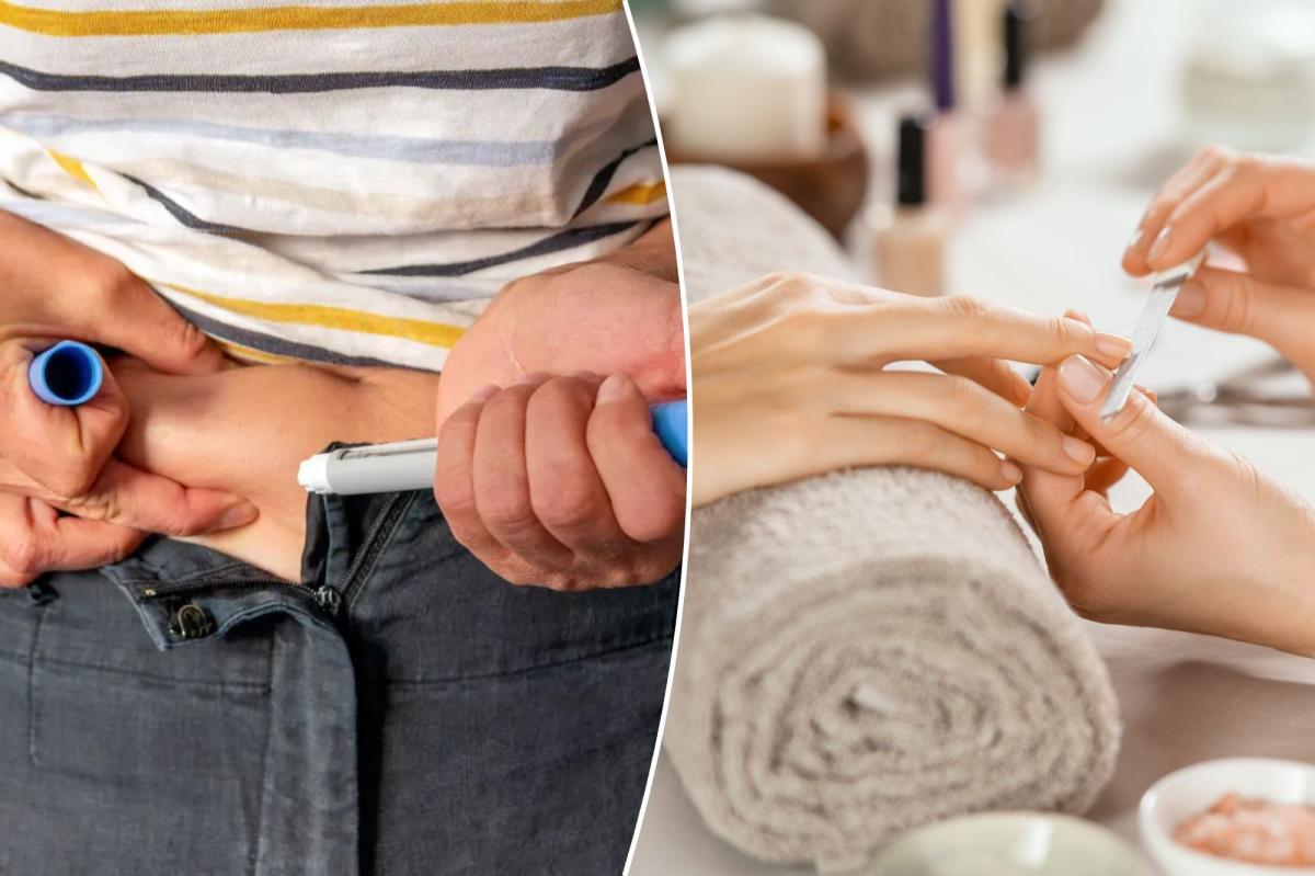 GLP-1s linked to a gross side effect in nails: study