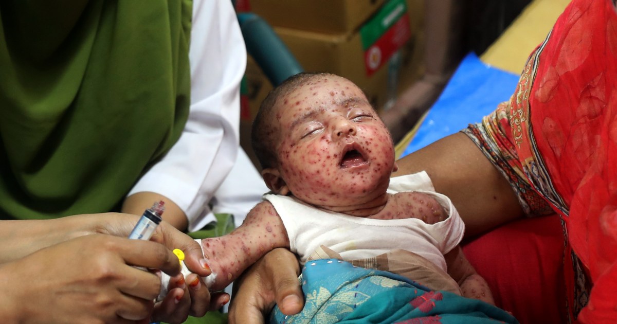 Measles outbreak in Bangladesh is a ‘real warning’ to other nations, experts say