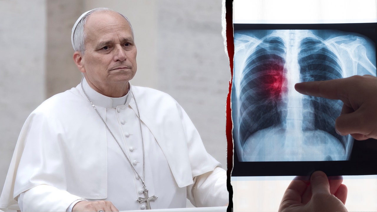 Pope's diagnosis shines light on surprising lung cancer risks for never-smokers