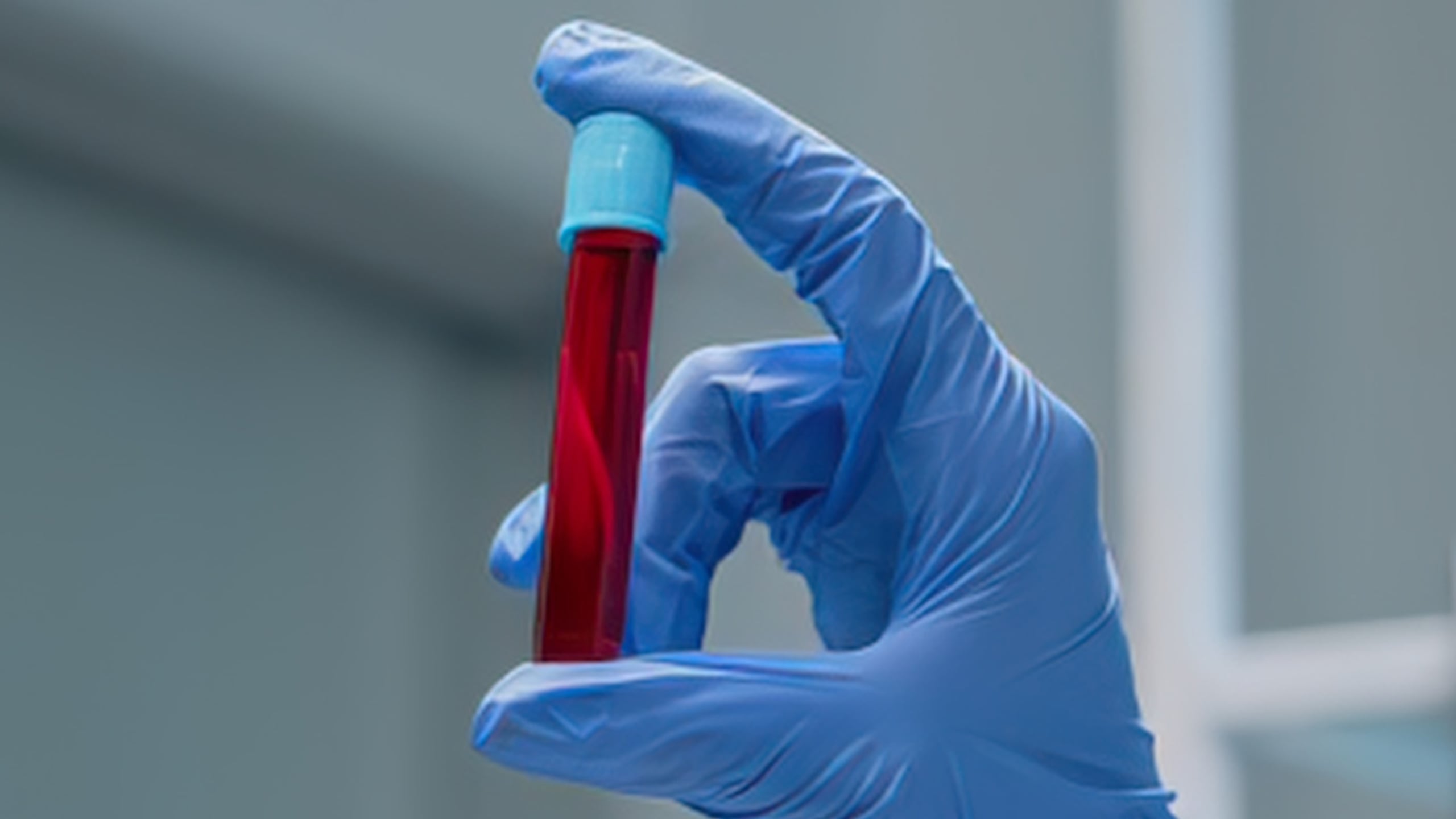 We May Have Been Wrong About Fasting Before Blood Tests, Study Reveals : ScienceAlert