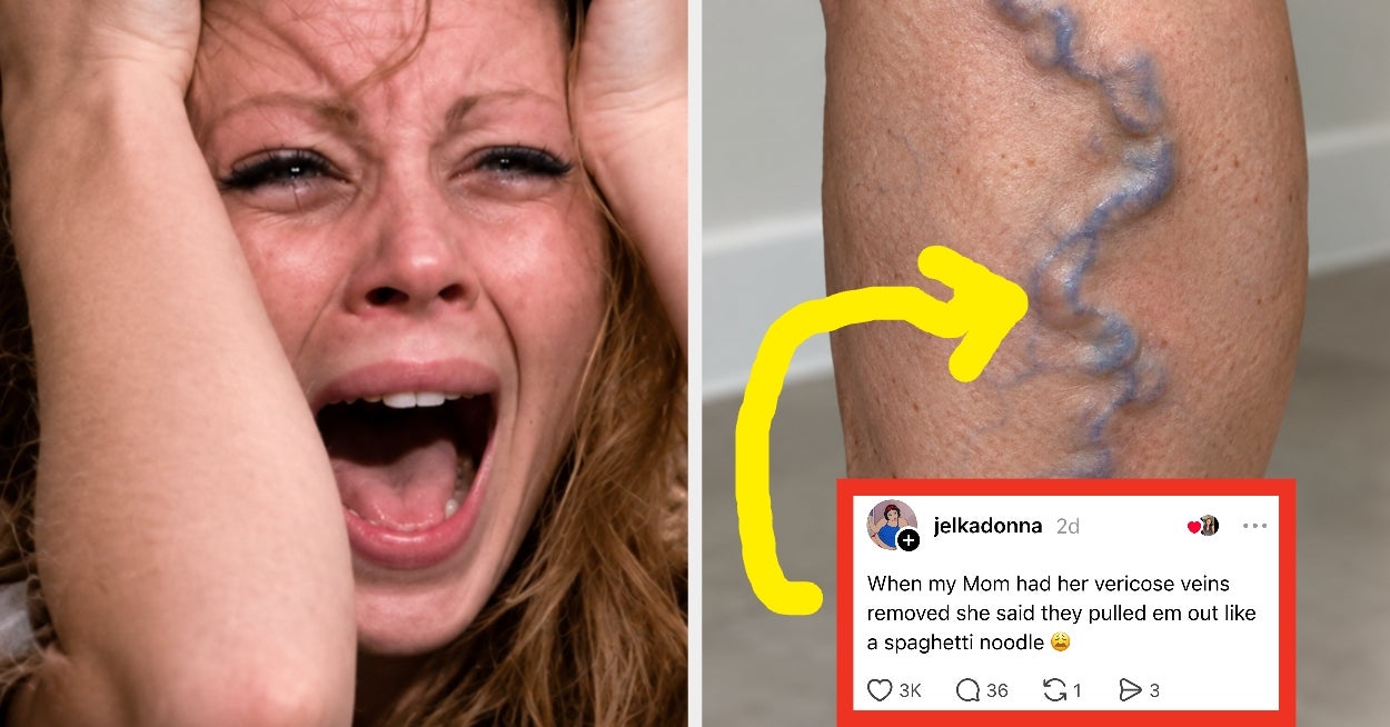 "When My Mom Had Her Varicose Veins Removed She Said They Pulled Em Out Like A Spaghetti Noodle 😩": People Are Sharing Wild Things About The Human Body That Most People Don't Know, And They're So Unsettling They're Going Viral - BuzzFeed