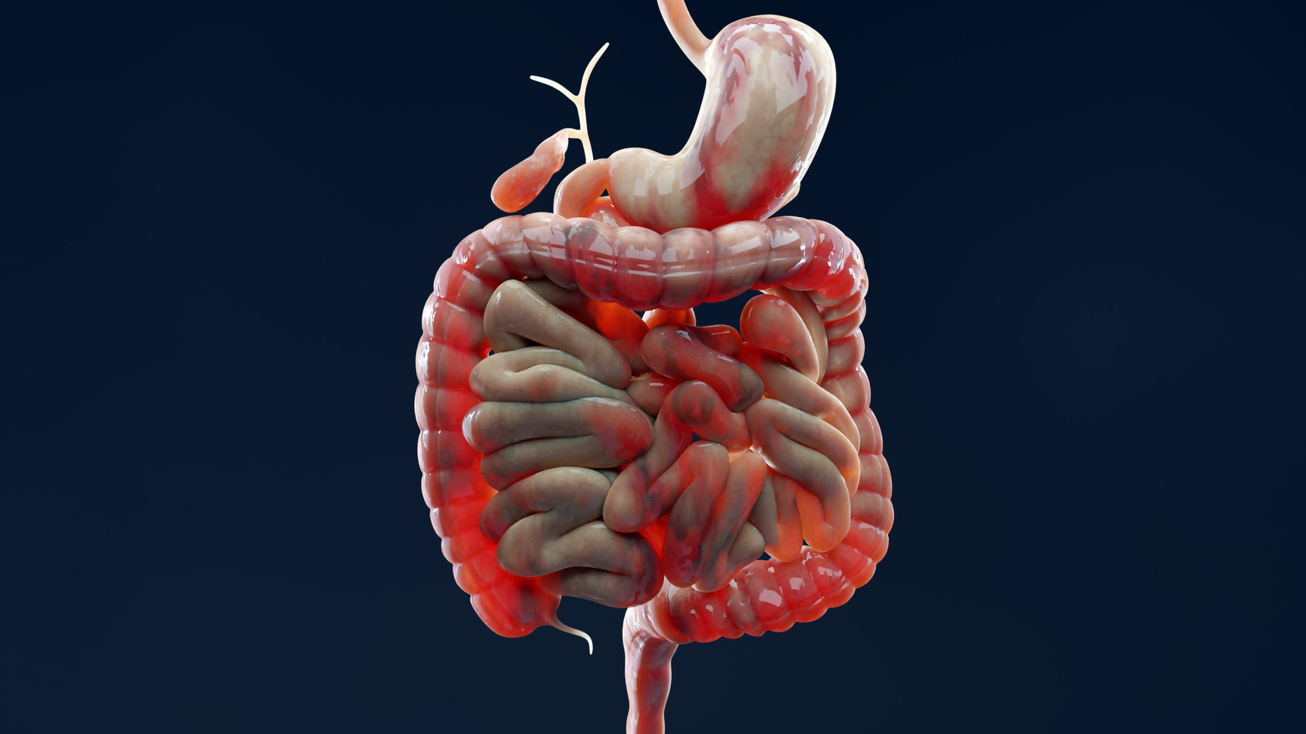Why Does IBD Keep Flaring Up? Scientists Found a Clue in The Gut Lining : ScienceAlert